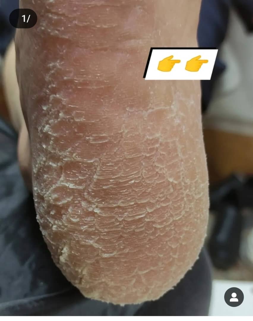 مزایای انجام پدیکور مزایای انجام پدیکور